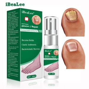 Nail Fungus Treatment Feet Care Essence Nails Foot Repair Toe Nail Fungal Removal Gel Anti Infection Paronychia Onychomycosis